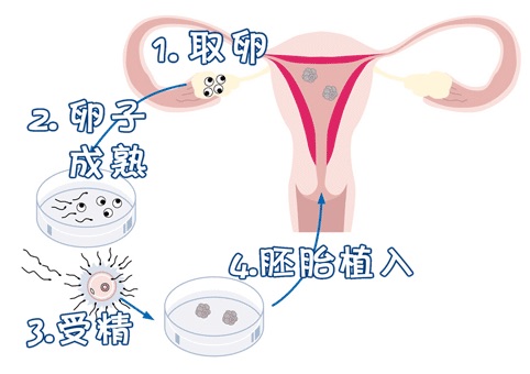 方鉴生殖医学中心